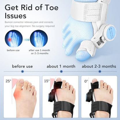 VitalStride Bunion Corrector Pro
